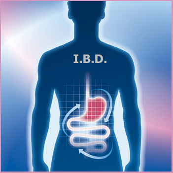 Biosimilars for inflammatory bowel disease in Norway